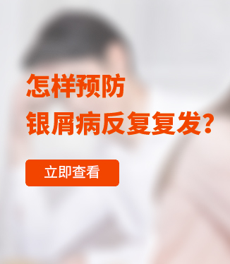 怎樣預(yù)防銀屑病反復(fù)復(fù)發(fā)？