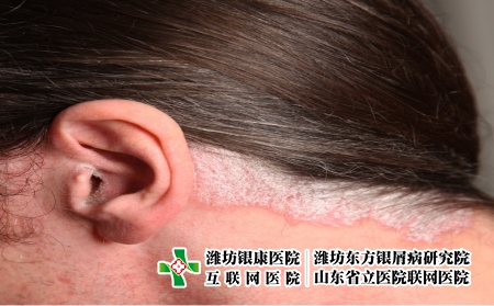 攝圖網(wǎng)_327944169_耳部和頸部的psorp絲蟲病（企業(yè)商用）