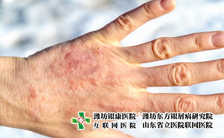攝圖網(wǎng)_305177811_詳細縫合干成熟女手照護和皮膚病癥概念詳細縫合干成熟女手（企業(yè)商用）