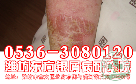 運動理想實現自愈嗎
